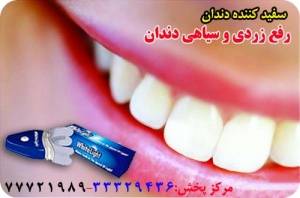 سفید کننده دندان وایت لایت