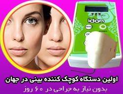 کوچک کننده بینی آیدانidan