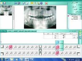 نرم افزار مدیریت مطب دندان پزشکی