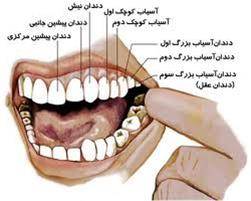 مرکز تخصصی کشیدن دندان-کودک و بزرگسال