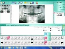 نرم افزار مدیریت مطب دندان پزشکی