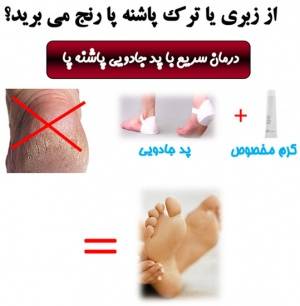 برطرف کردن ترک پا