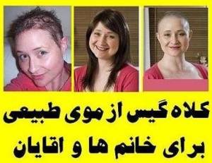 سفارشی کلاه گیس زنانه و مردانه از موی طبیعی انسان برای خانم ها و آقایان